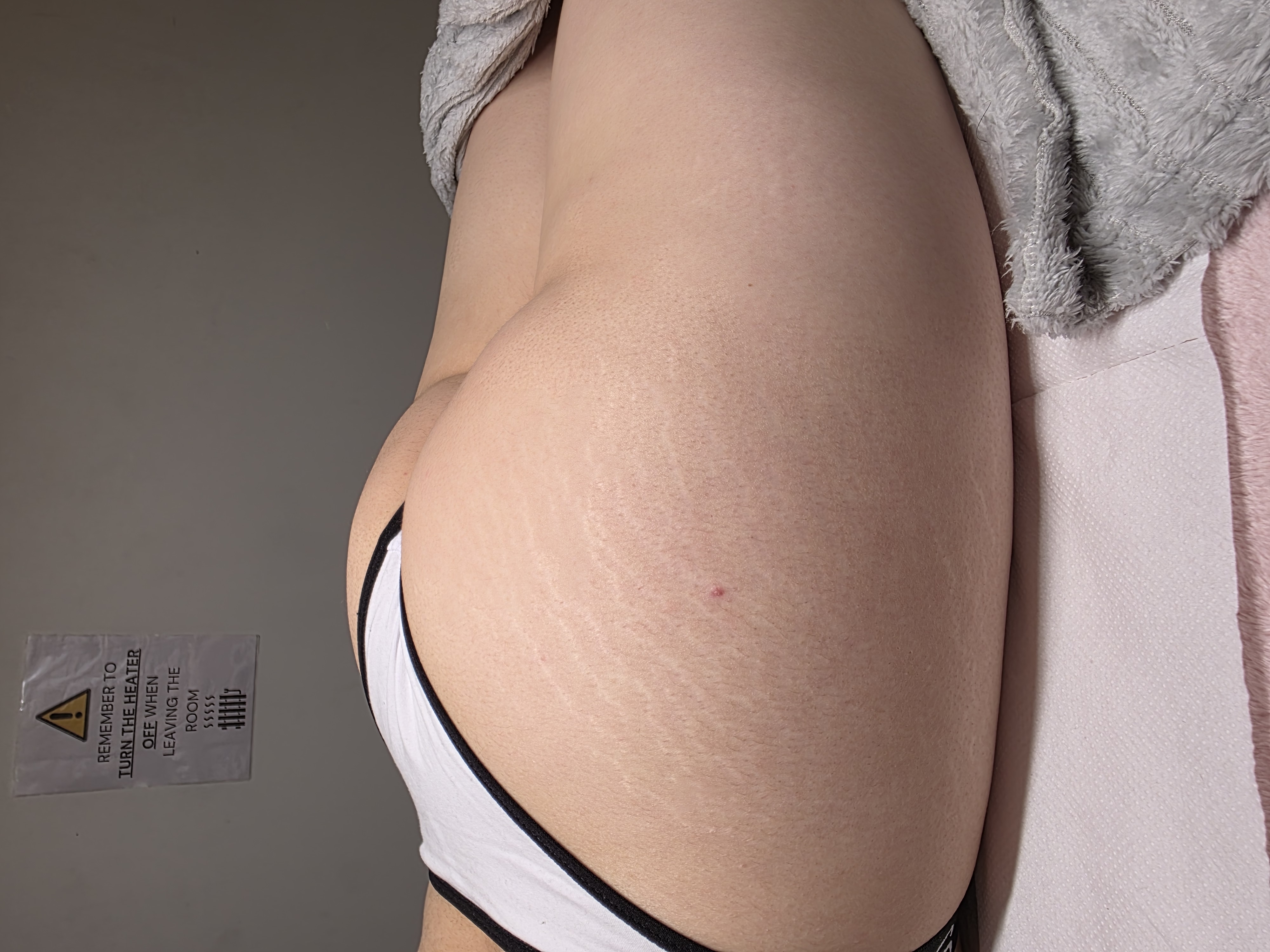 Before Dermapoint Protocol